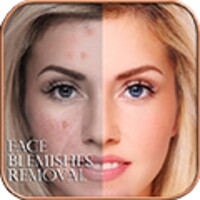 Face Blemishes Removal thumbnail