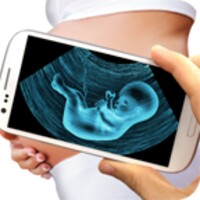 Ultrasound Scanner (Prank) thumbnail