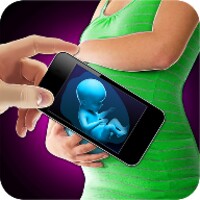 Xray Scanner Pregnant Prank thumbnail
